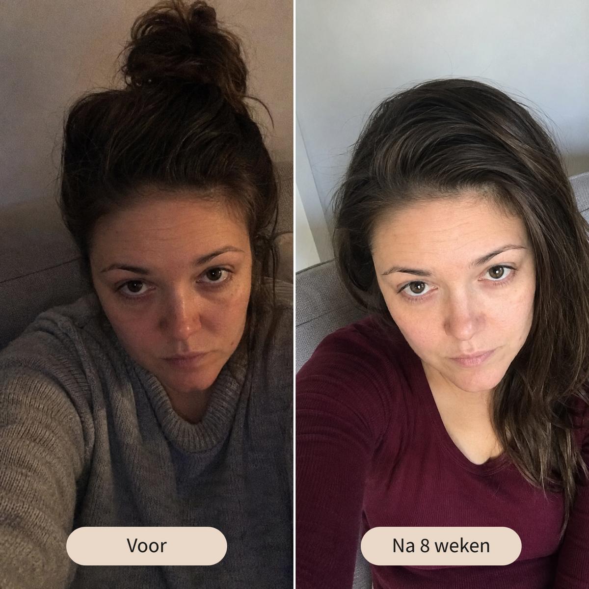 Voor en na 8 weken dagelijks gebruik van de Ritual Stick